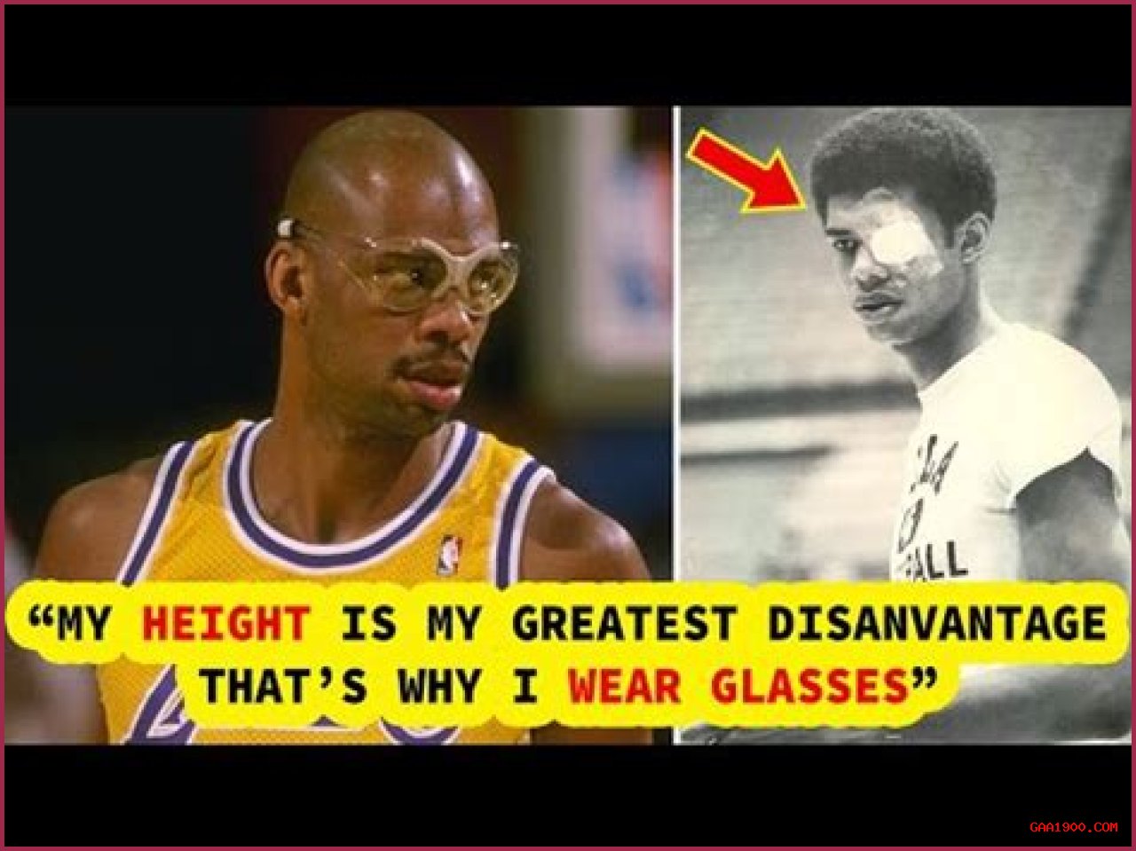 Why did Kareem Abdul-Jabbar wear goggles?